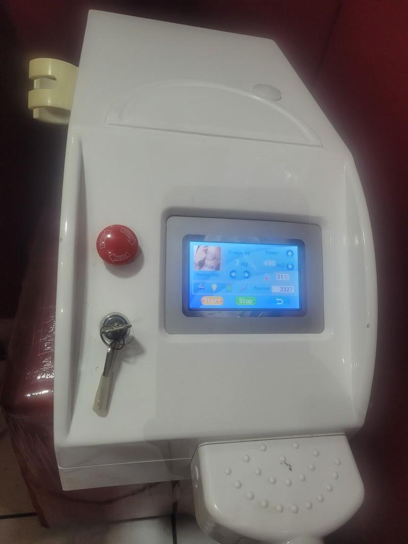 Mbuya Tattoo Removal - Photo 2